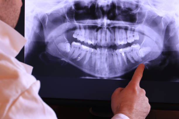 Best Weekend Emergency Dentist in Denton, TX