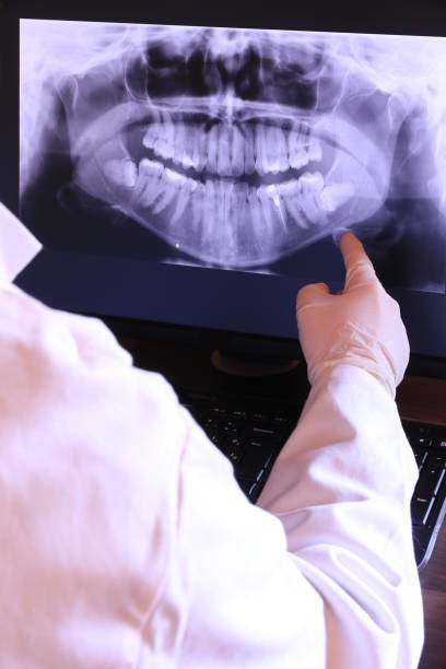 Best Emergency Dental Care for Broken or Chipped Teeth in Denton, TX