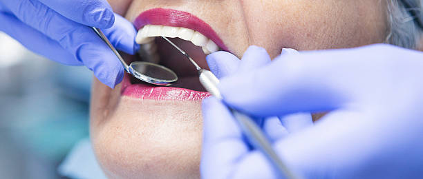 Best Emergency Gum Treatment in Denton, TX
